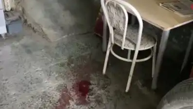 Sandalyeden Düşen Adamın Hayatı Değişti: Olayın Ardındaki Korkunç Gerçek
