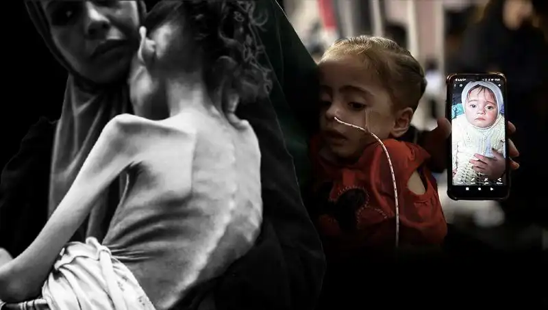Küçük Meryem'in Dramı: 25 Kilo Olan Çocuk Şimdi 10 Kilo ile Hayata Tutunuyor