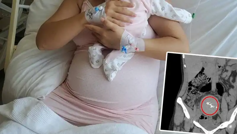 Doğumda İhmal! Gazlı Bez İki Yıl Sonra Ortaya Çıktı